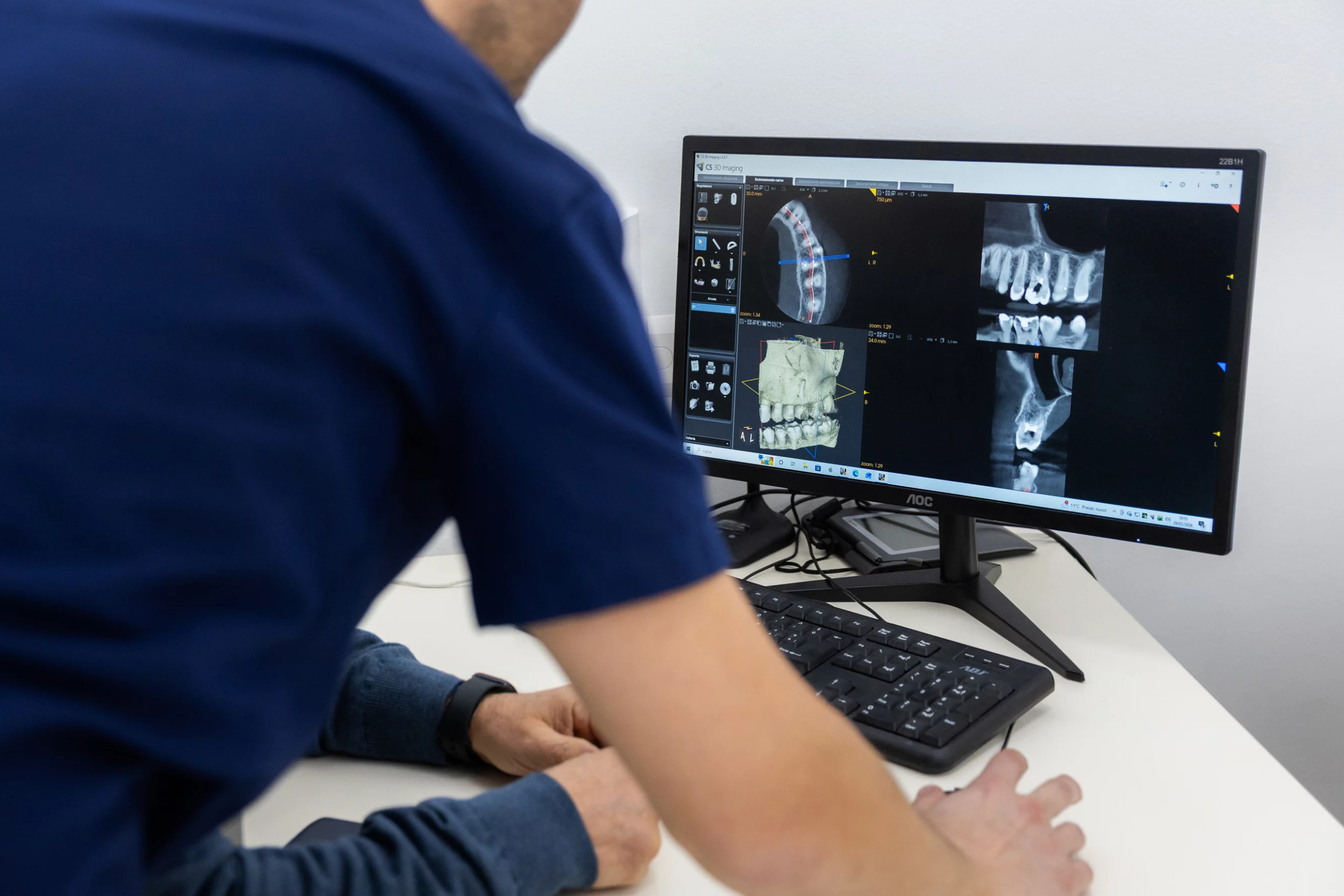 Chirurgia orale e implantologia - Nicola Ranieri Dental Clinic