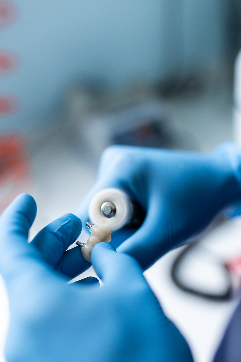 Protesi dentaria Protesi Dentaria impianto e riparazione - Nicola Ranieri Dental Clinic