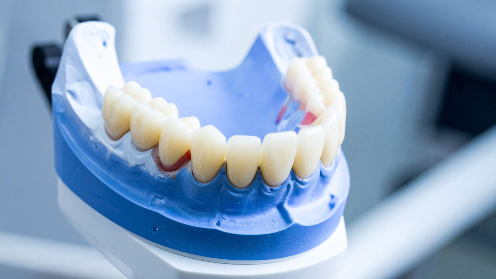 Igiene dentale professionale a santa Caterina dello ionio - nicola ranieri dental clinic
